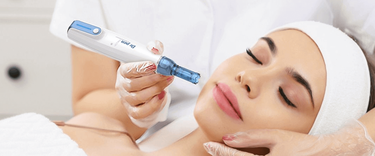 Microneedling θεραπεία προσώπου για ανάπλαση δέρματος και παραγωγή κολλαγόνου στο Beauty Secrets